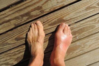 How Flat Feet Can Impact Your Overall Foot Health