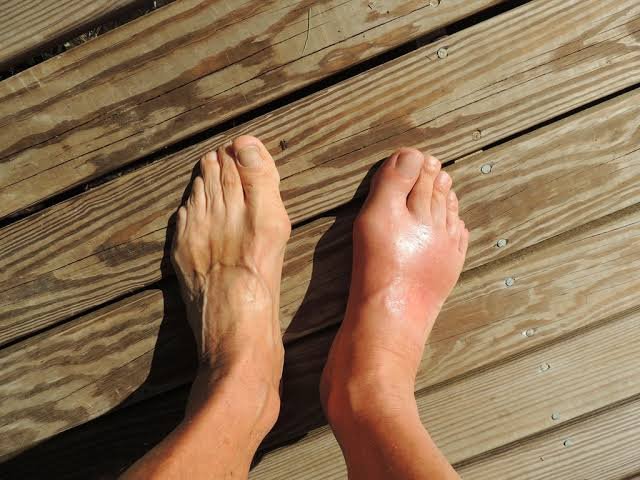 How Flat Feet Can Impact Your Overall Foot Health